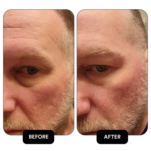 Cupids Rejuvenating Tallow Serum